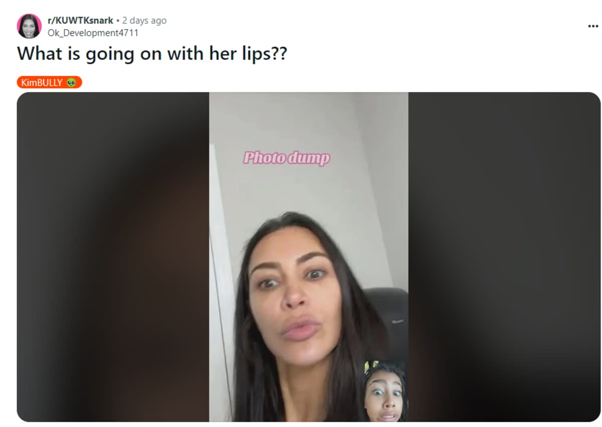 Image Source: Reddit | @KUWTKsnark