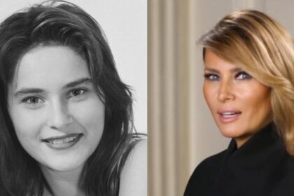 Melania Trump Before and After