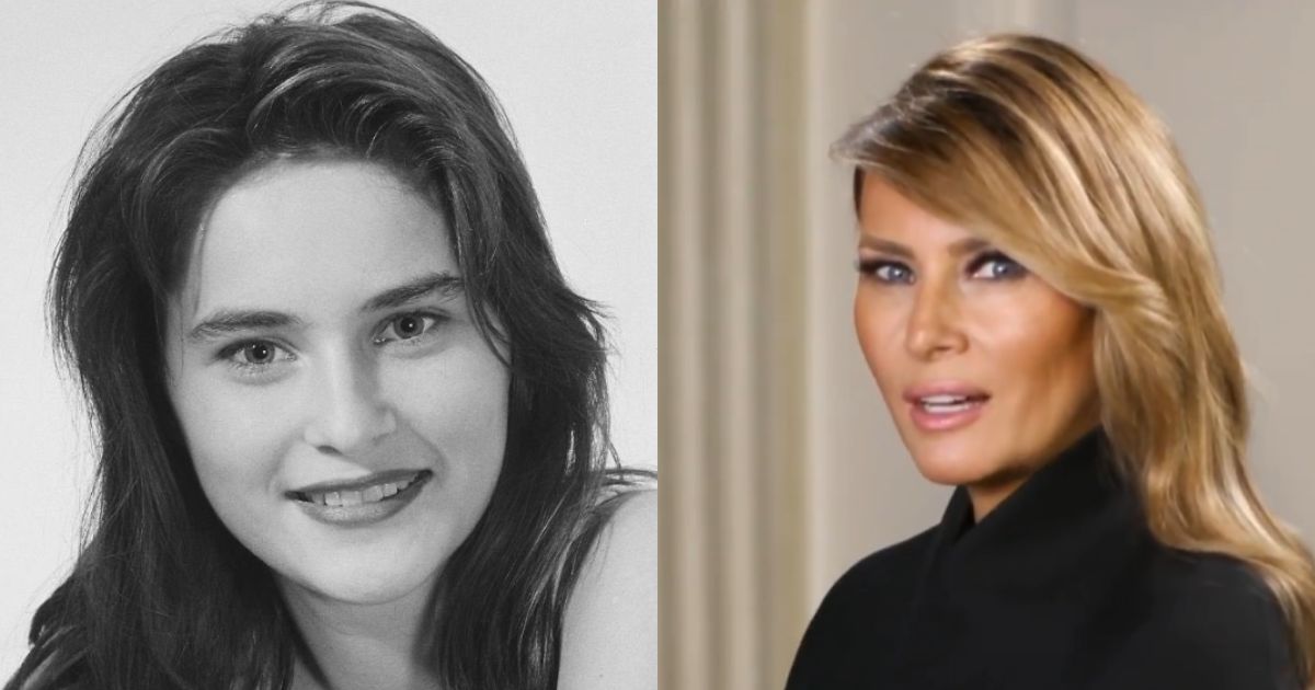 Melania Trump Before and After