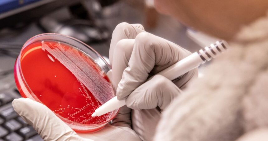 Candida auris is a fungal infection spreading rapidly through US hospitals