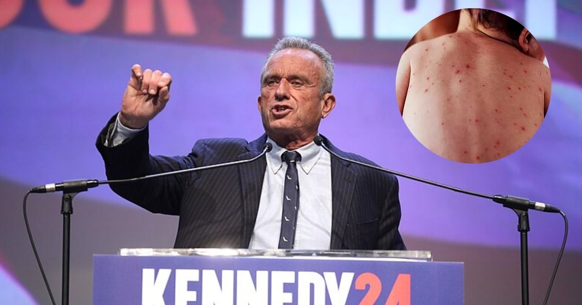 RFK Jr. speaking with supporters at a campaign rally at the Fox Tucson Theatre in Tucson, Arizona. ( credits- Gage Skidmore via Flickr) Picture Inside the circle ( a young infant with measles) (via FMT)