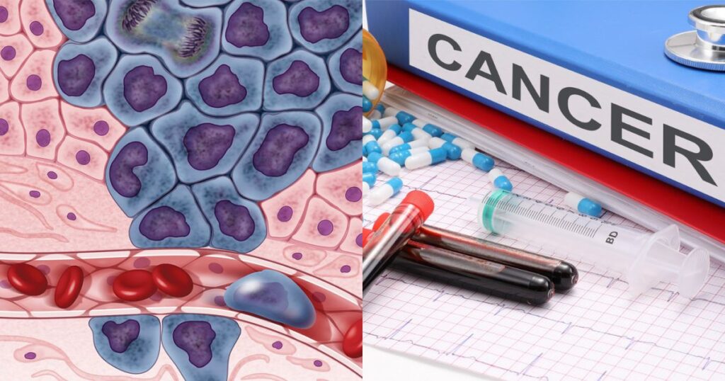 Cancer in blood cells Left—(Picture by NH Image Gallery-—via Flickr) and (By NickYoungson-—via Creative Commons - Blue Diamond Gallery)