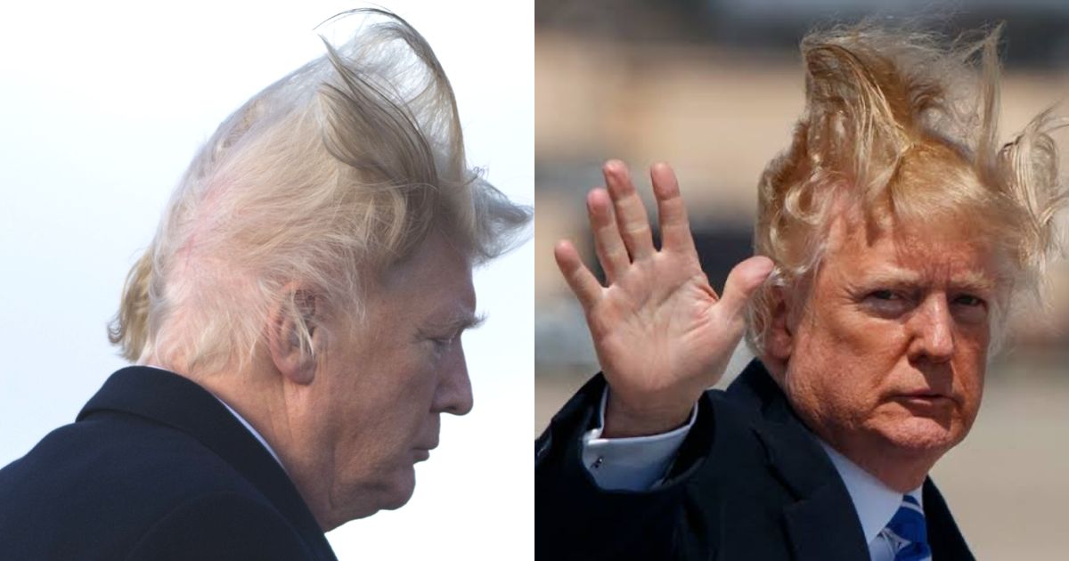 Donald Trump's Bald Patches Create Stir on Social Media