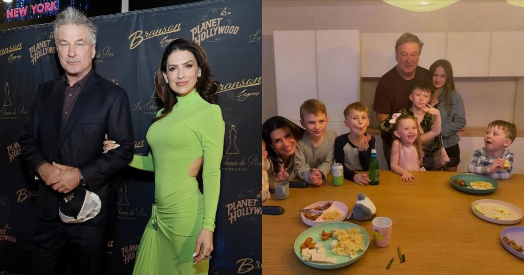 Alec Baldwin’s Wife Hilaria undergoes a mysterious procedure.