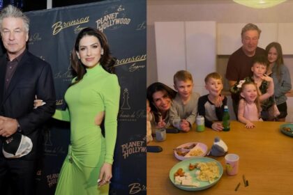 Alec Baldwin’s Wife Hilaria undergoes a mysterious procedure.