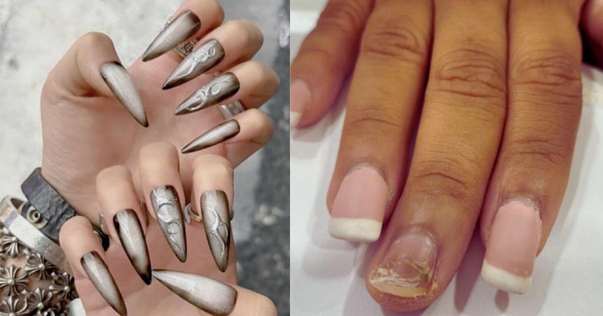 Pretty nail extensions (R)—Source: Instagram | @nail_unistella and Nail infection after extensions (L)—Source: Instagram | @sachipuri_md