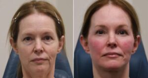 Margot, Before and After Plastic Surgery