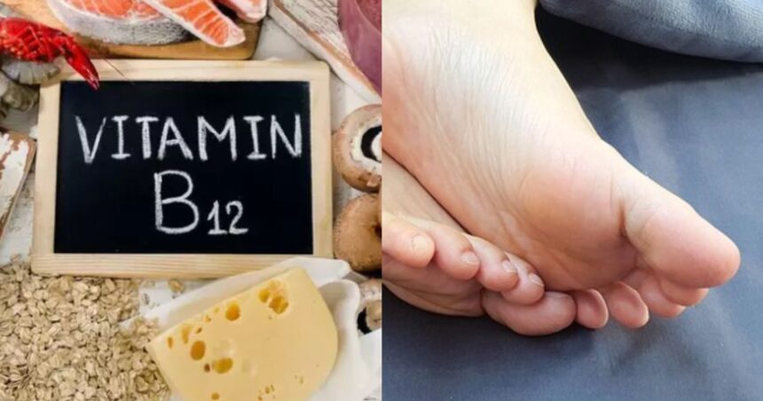 Vitamin B12 Deficiency Sign That Could Show Up In Your Toes