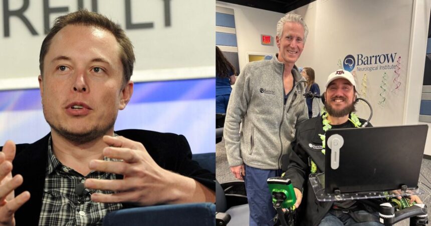 Noland Arbaugh has Elon Musk's Neuralink brain chip.