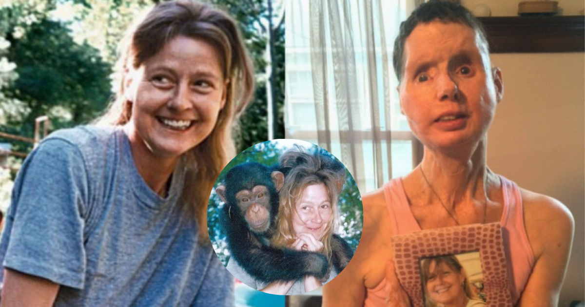 Charla Nash was the victim of a pet chimp