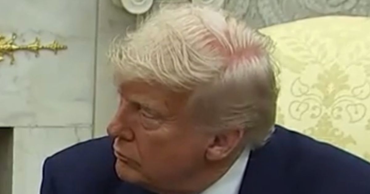 Donald Trump's bald spot 
