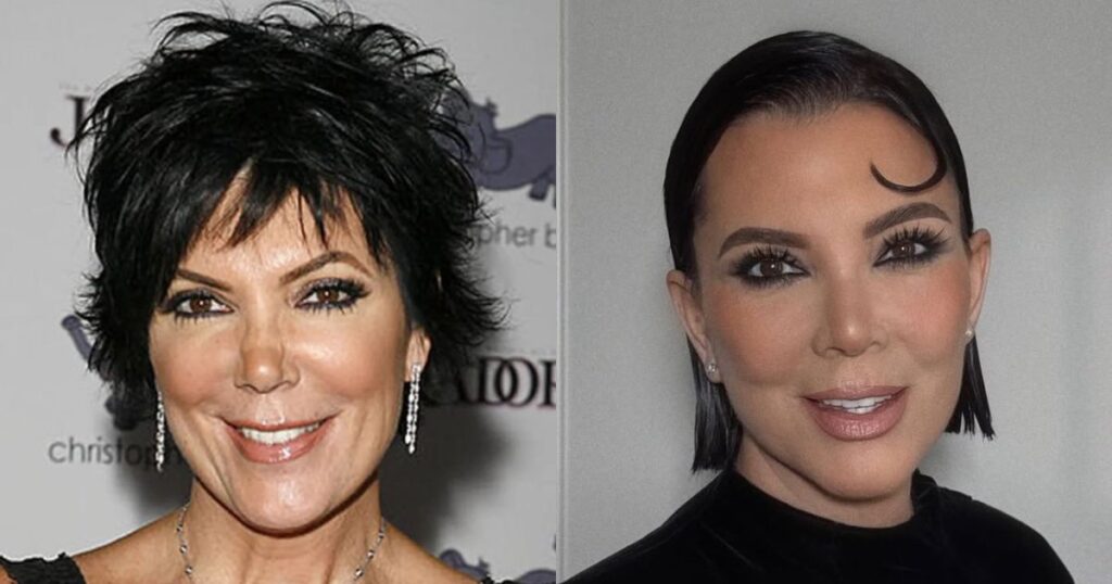Kris Jenner’s Bizarre $1M Beauty Secret