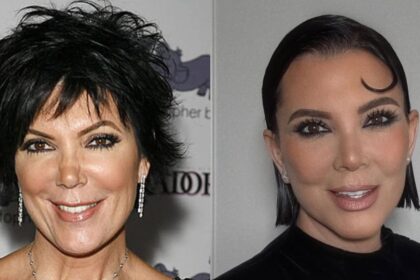 Kris Jenner’s Bizarre $1M Beauty Secret