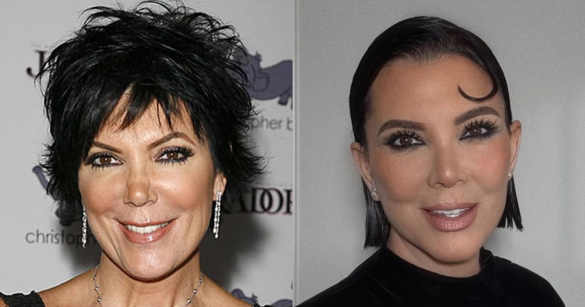 Kris Jenner’s Bizarre $1M Beauty Secret