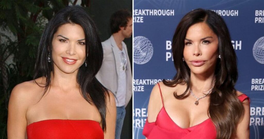 Lauren Sanchez's expensive plastic surgeries