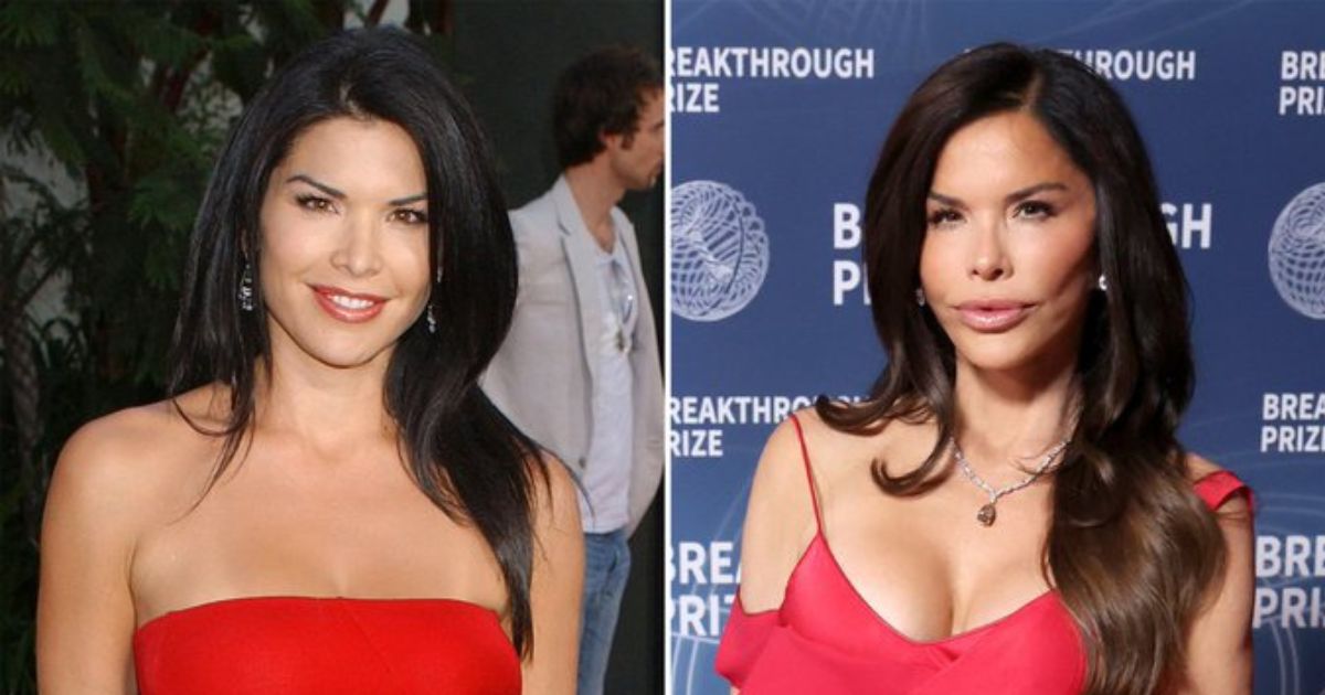Lauren Sanchez's expensive plastic surgeries