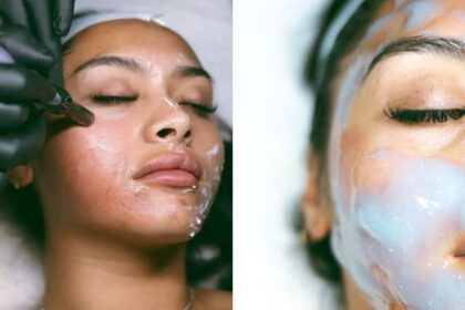 A women getting Micro-needling for a youthful glow rather than harsh plastic surgery (left-both picture via the injection room)
