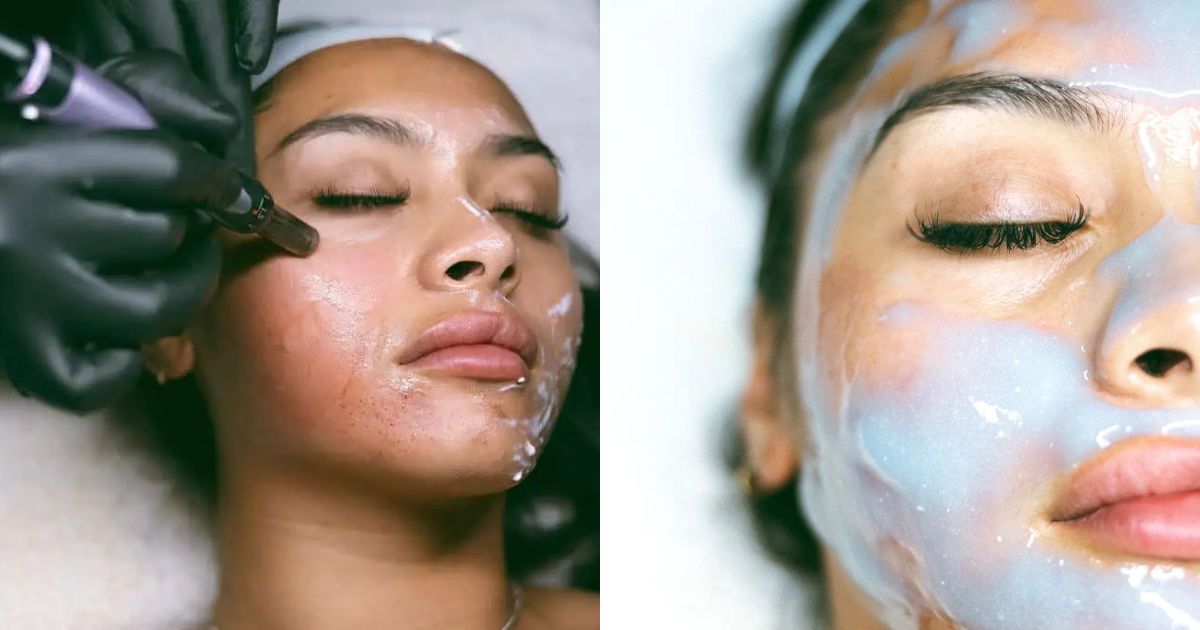 A women getting Micro-needling for a youthful glow rather than harsh plastic surgery (left-both picture via the injection room)