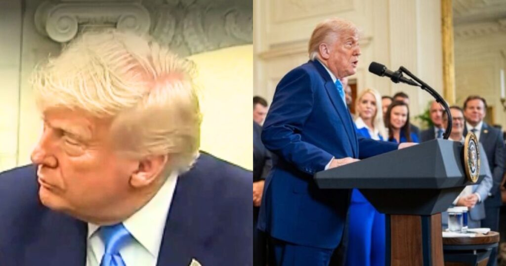 Trump Bald Spot Goes Viral