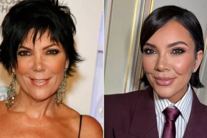 Kris Jenner's expensive, risky and rare facelift
