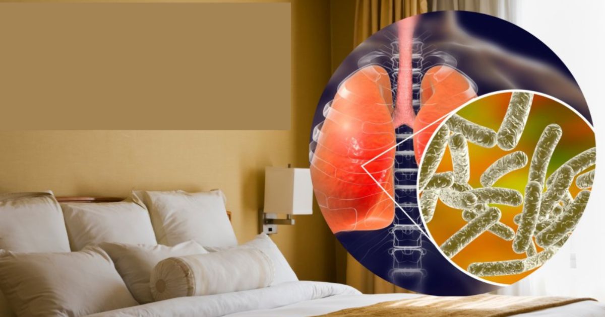 Legionnaires' disease