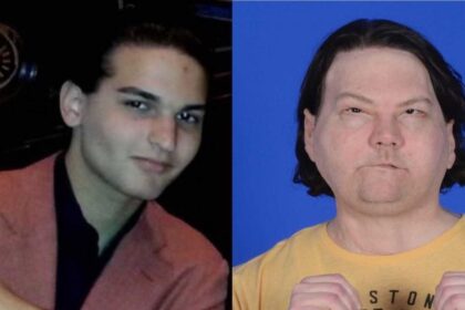 New Jersey teen undergoes face and hand transplant