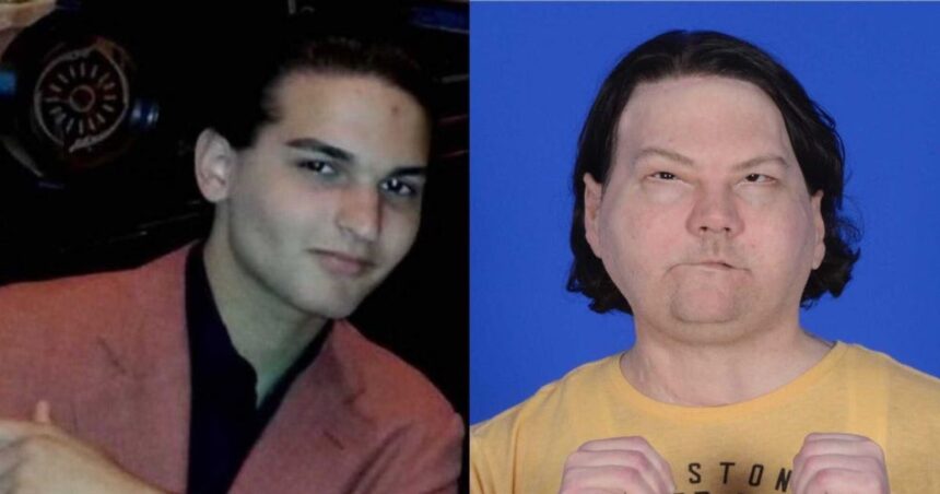 New Jersey teen undergoes face and hand transplant