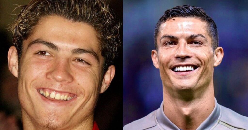 Ronaldo's Changing Face Over the Years Has Fans Talking
