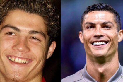 Ronaldo's Changing Face Over the Years Has Fans Talking