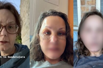 50-year-old's facelift transformation leaves netizens stunned.