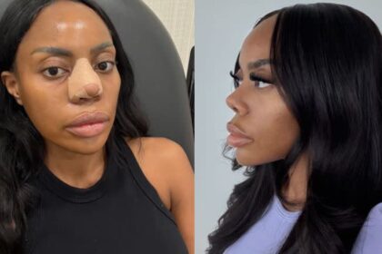 Zuri's Nose Job 'Deal' Has the Internet Talking