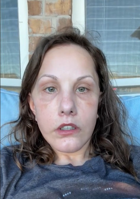 Michelle Wood stuns people with post recovery look