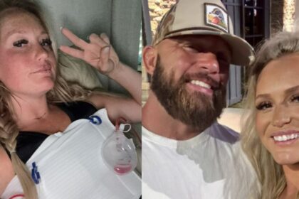 A woman suffered horrible after effects of botox