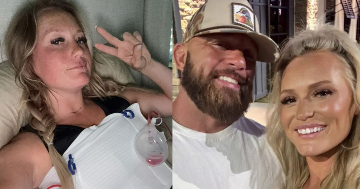 A woman suffered horrible after effects of botox