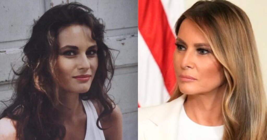 Before and After Photos of Melania