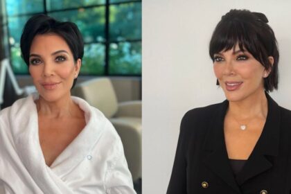 Kris Jenner's plastic surgery transformation over the years