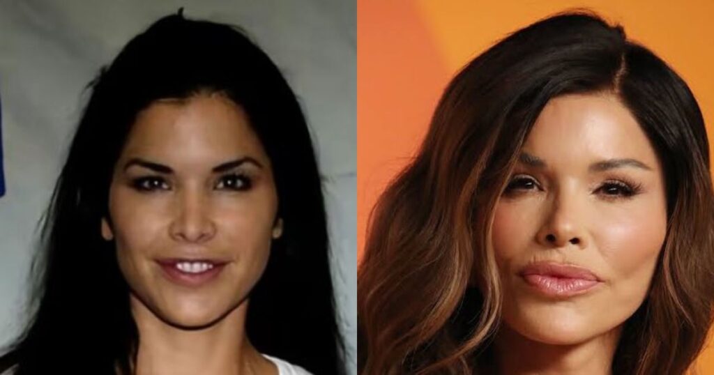 Lauren Sanchez Before and After