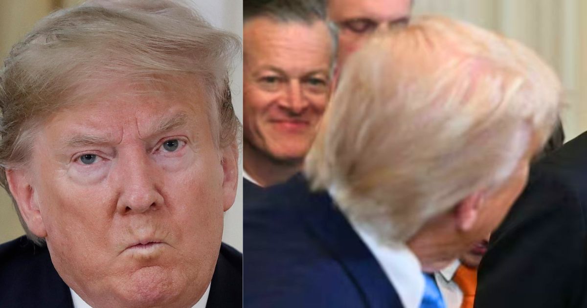 Donald Trump Bald Hair