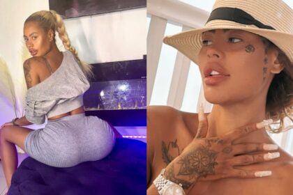 Chelsea Robinson shares story of her plastic surgery gone wrong