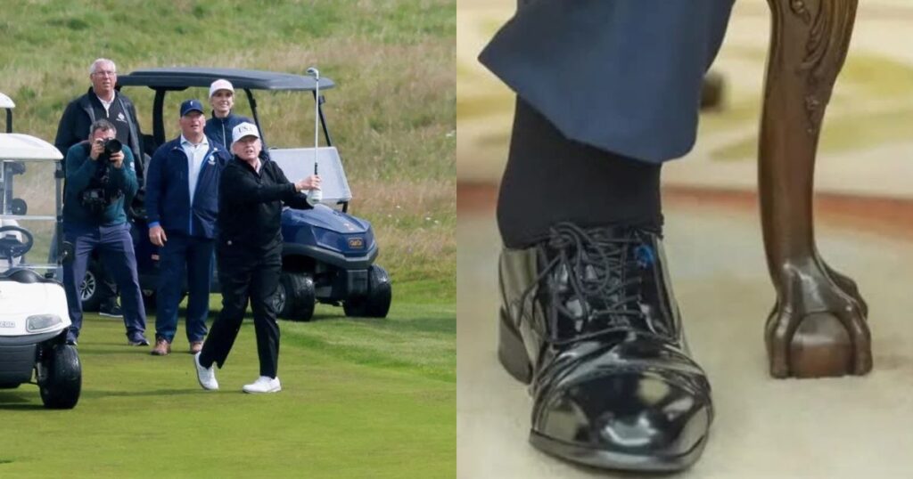 Close-up of Donald Trump's swollen ankle at a political event