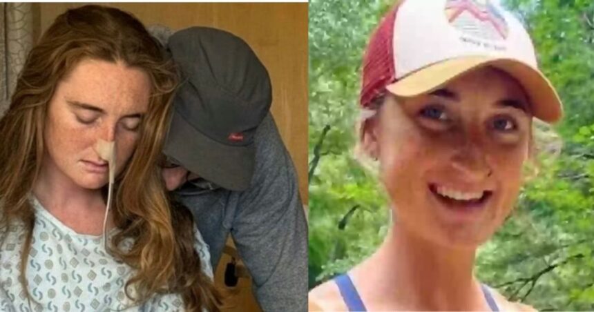 Radwah Oda- Colon Cancer