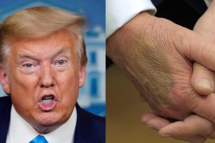 Concerns about Donald Trump's health during his second term