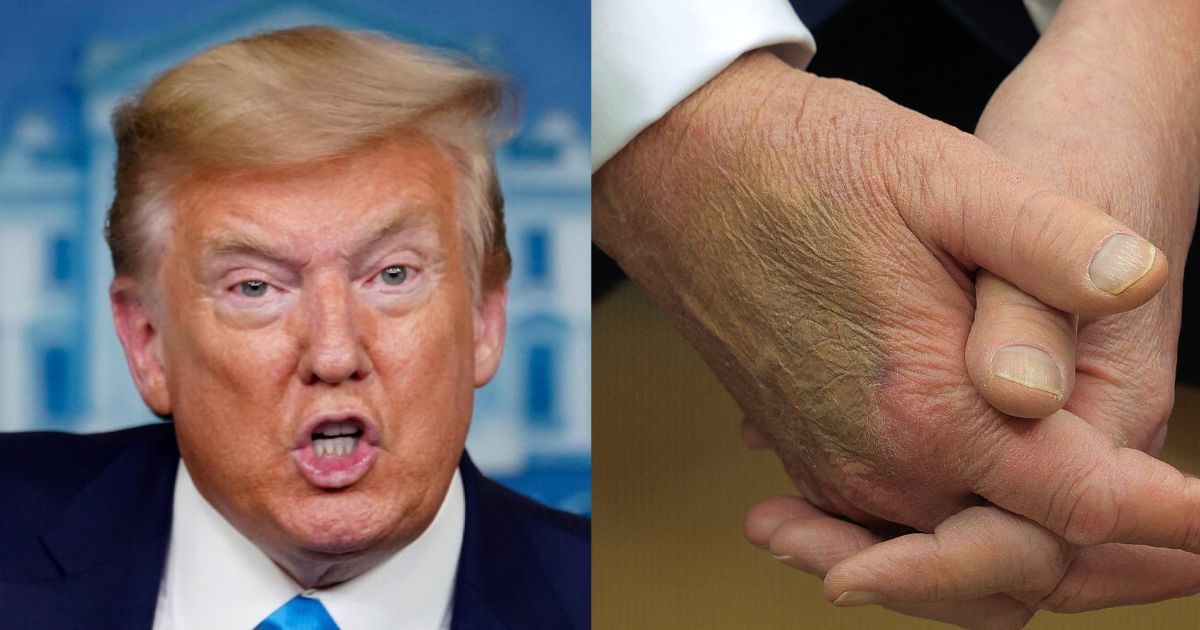 Concerns about Donald Trump's health during his second term