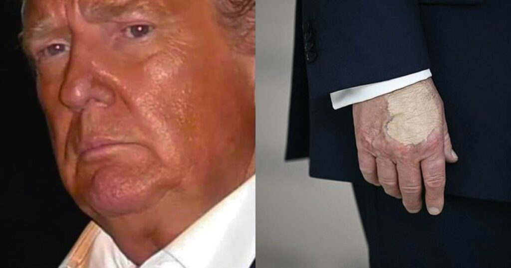 Donald Trump’s bronzer betrayed him as his makeup visibly rubbed off on his shirt collar during a press briefing