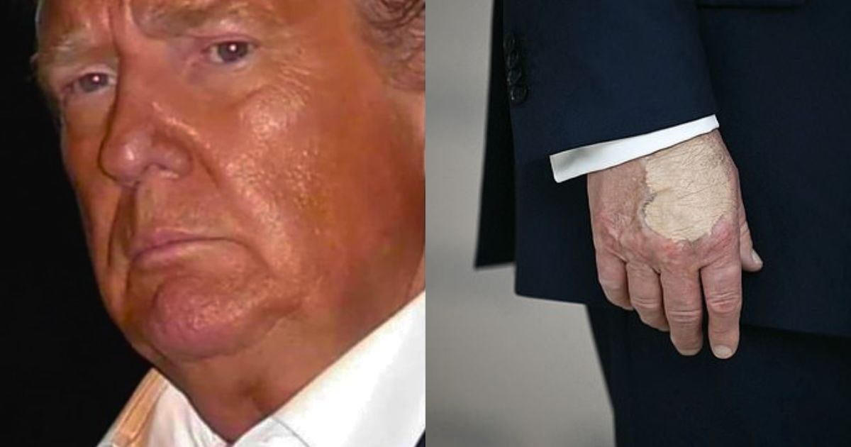 Donald Trump’s bronzer betrayed him as his makeup visibly rubbed off on his shirt collar during a press briefing