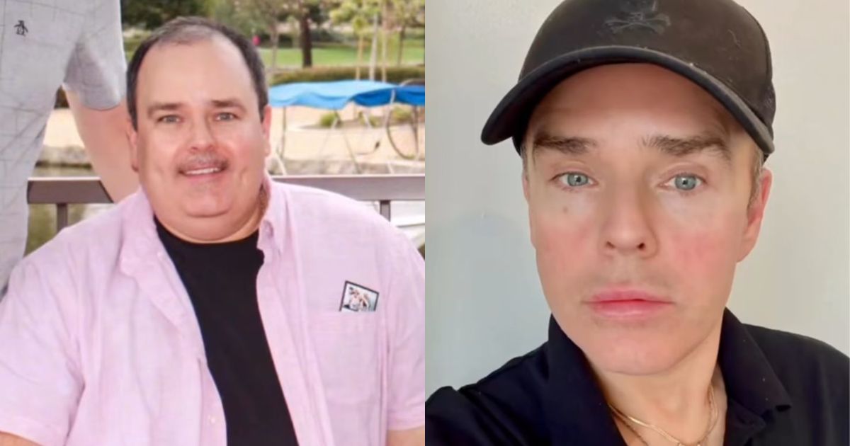 Man's plastic surgery transformation leaves netiznes in awe