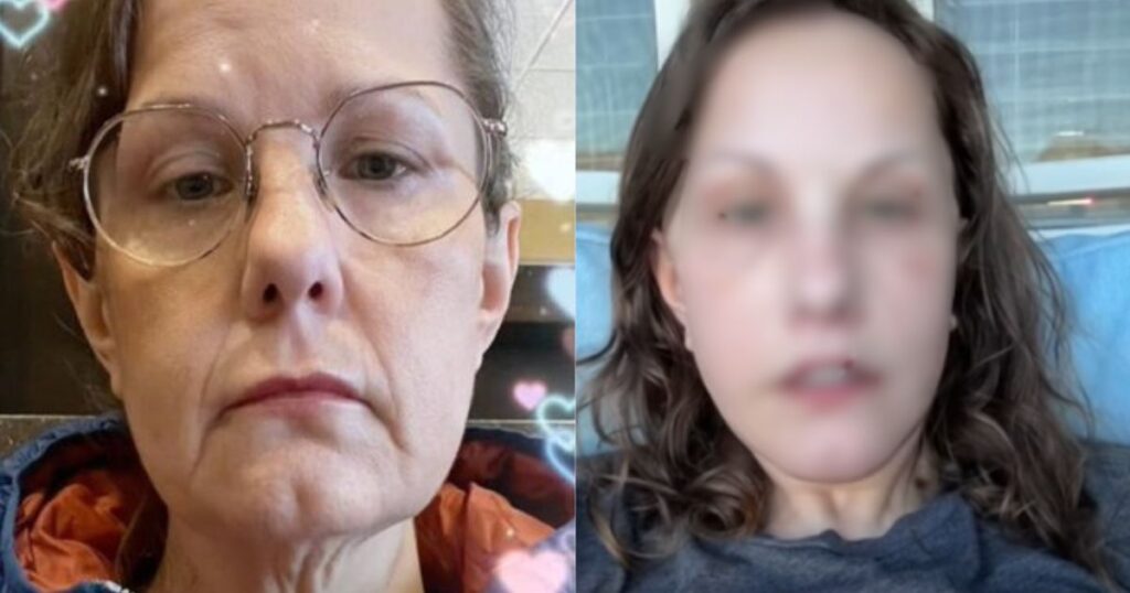 Michelle Wood gets facelift in Mexico