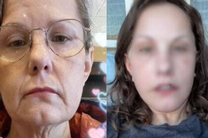 Michelle Wood gets facelift in Mexico