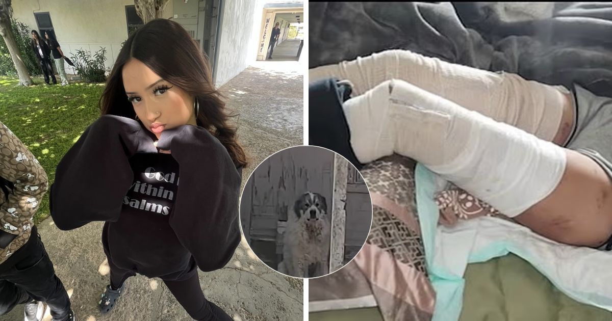 Tracy Hurtado endured nearly 100 dog bites