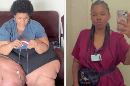 Woman shares how a diagnosis helped her reduce weight